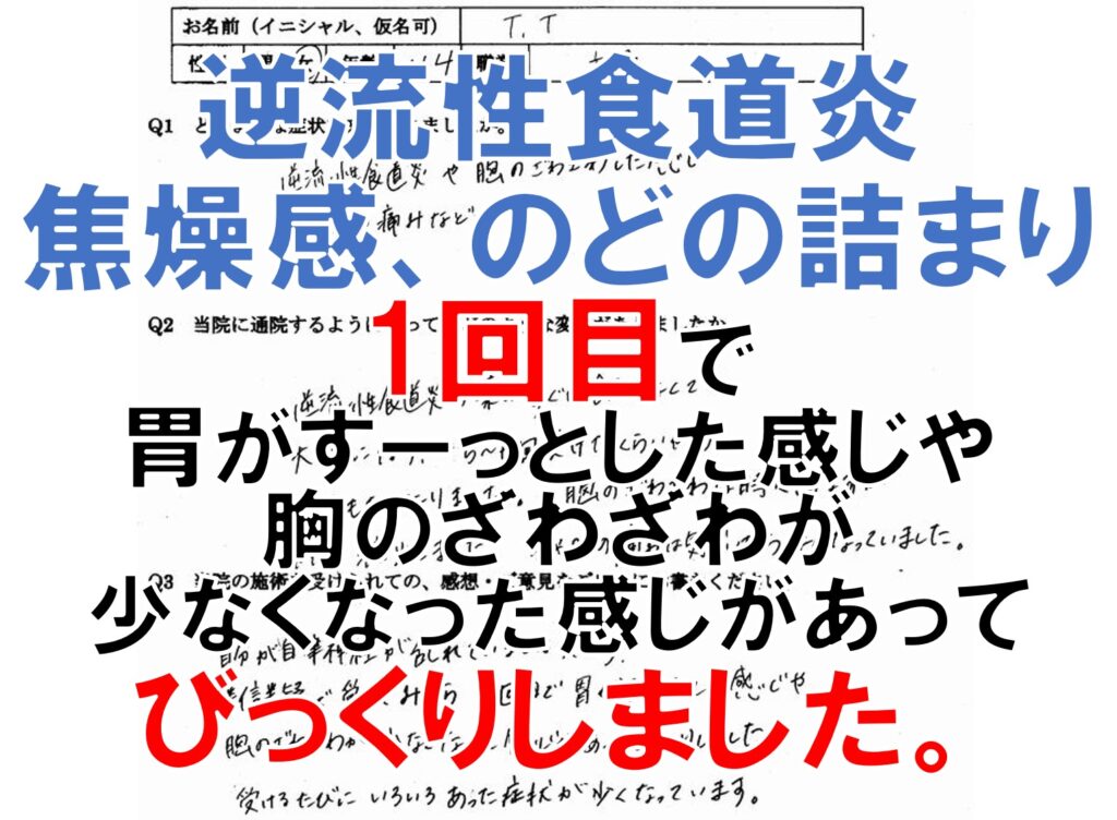 逆流性食道炎、焦燥感、動悸、ヒステリー球などの症状のある宇美町の方の口コミ