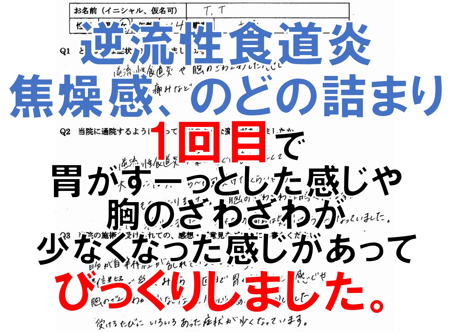 逆流性食道炎、焦燥感、動悸、ヒステリー球などの症状のある宇美町の方の口コミ