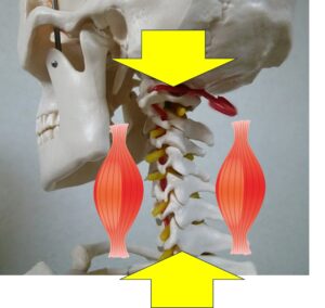 首の筋肉が緊張し椎間板に圧がかかる様子