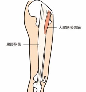 腸脛靭帯、大腿筋膜張筋