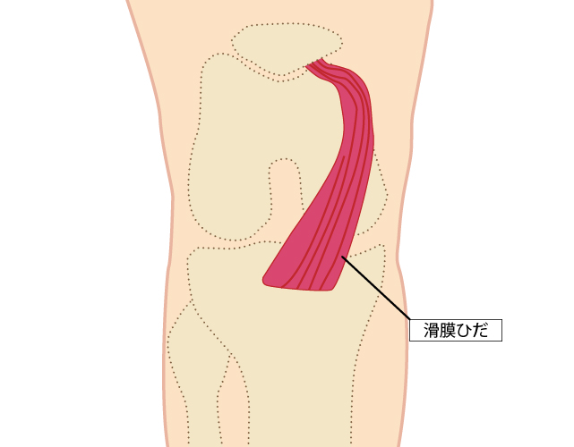 滑膜ひだ