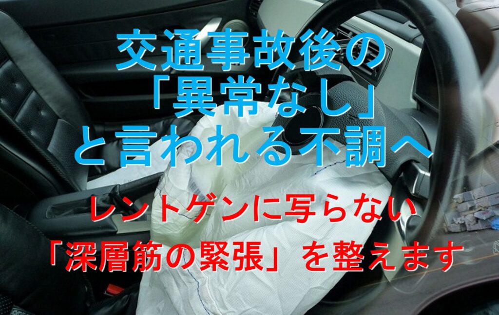 交通事故でエアバッグが出ている様子